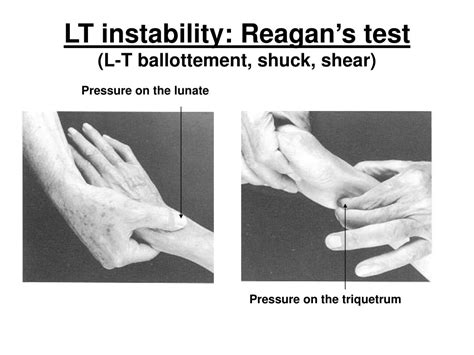 shear and lt compression test|lt interosseous injury positive test.